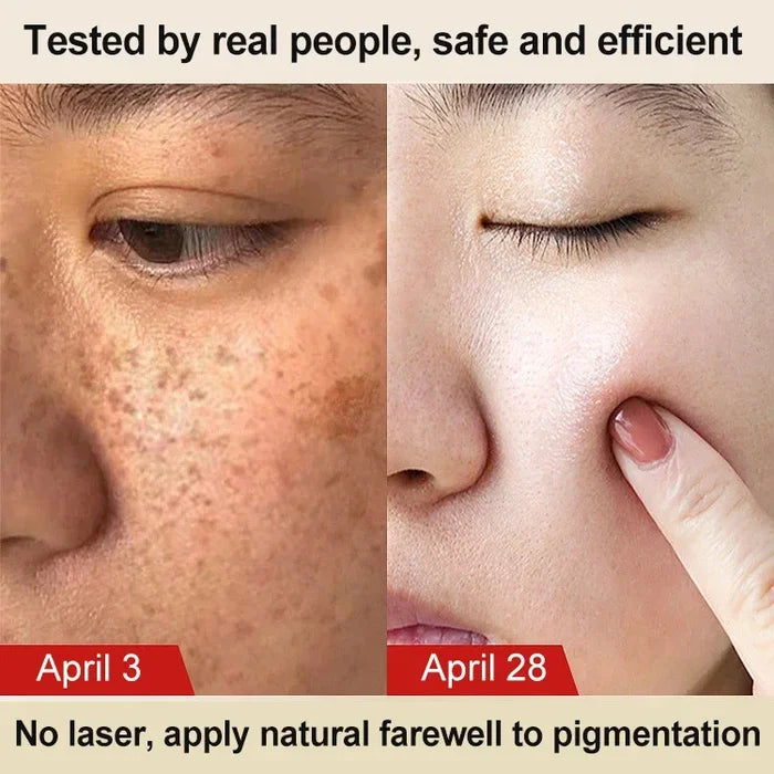 š„LAST DAY 51% OFFš„Herbal Astragalus Crea