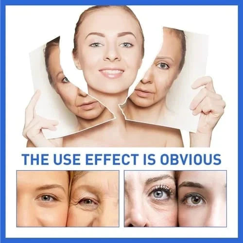 Last Day Promotion 70% OFF - đ„Botox Face Serum