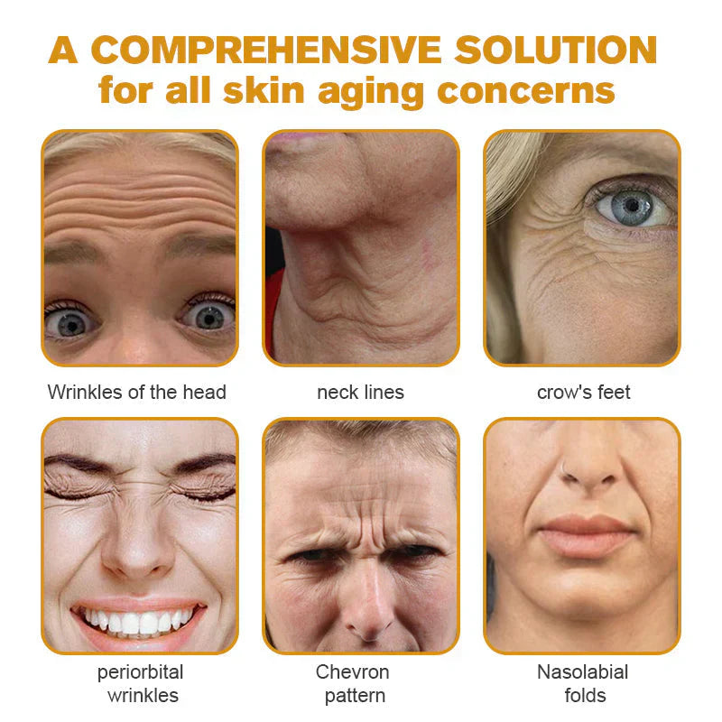 🔥Buy 1 Get 1 Free🔥Botox Bee Venom Wrinkle Removal Cream