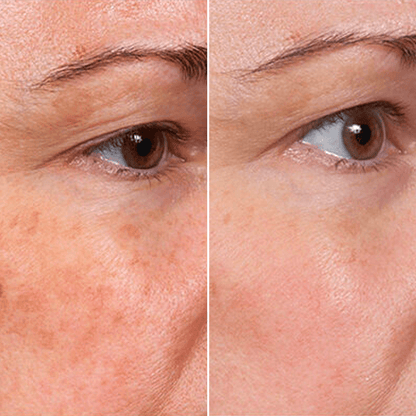 Rejuvenate Face Serum-🔥BUY 1 GET 1 FREE🔥