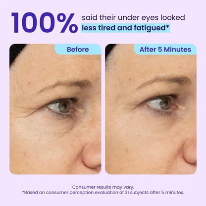 Erase Eye Bags in Minutes — Look Refreshed Instantly