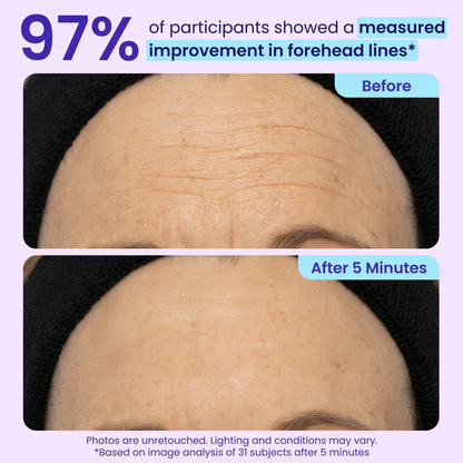 Erase Eye Bags in Minutes — Look Refreshed Instantly