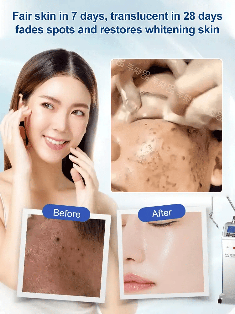 🔥BUY 1 GET 1 FREE 🔥 Spot Fading Urea Cream