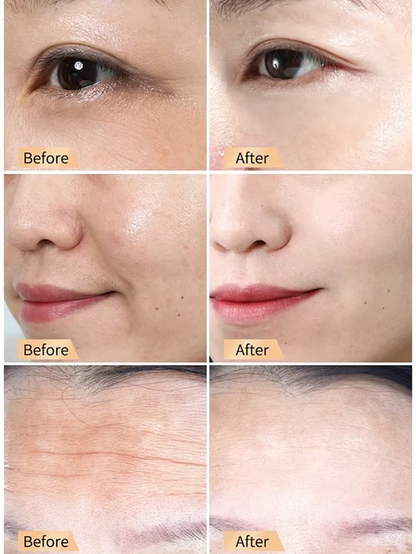 🔥BUY 1 GET 1 FREE!🎁[Secret to Youthful Skin] Snail Hydrating, Anti-Wrinkle and Rejuvenating Cream