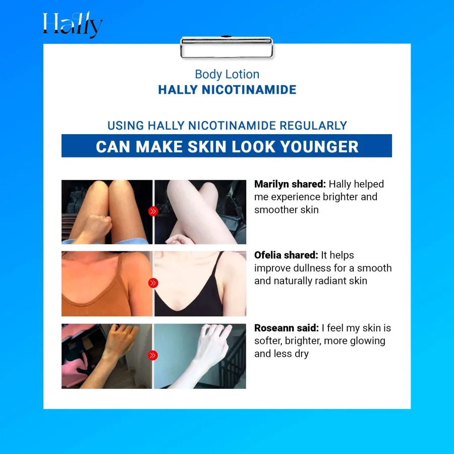 🎁Buy 2 Get 1 Free🎁FOriginal Hally Niacinamide Whitening Body Lotion