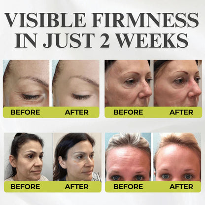 ⏰ FLASH SALE: 72-Hour Wrinkle Eraser |  Botox & Vita-A Retinol Shot Wrinkle - Lift Tightening Cream